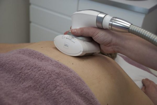Huidbehandelingen combineren - Endermologie medische behandelingen