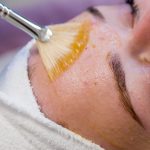 Huidproblemen - Acne - Kan Skin Clinic