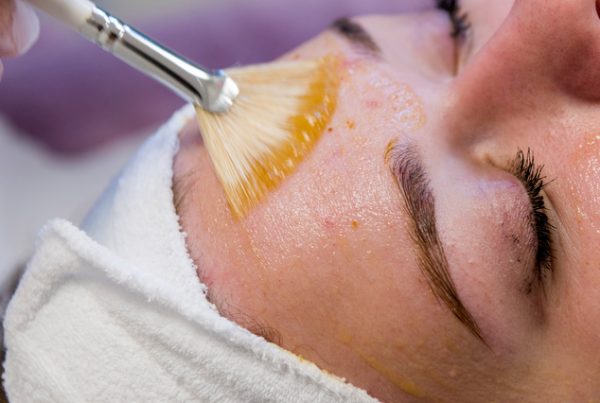 Chemische Peelings - Detox je huid met peeling - Kan Skin Clinic Bussum - Weesp