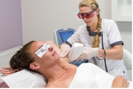 Laserontharing