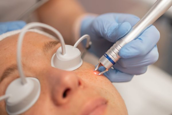 Elvii diode vaat en pigmentlaser
