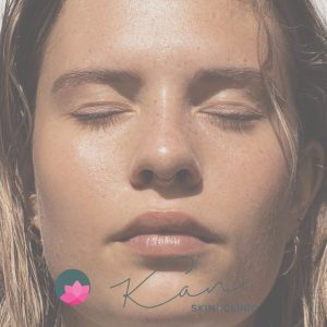 Huidverbetering - Medi facials