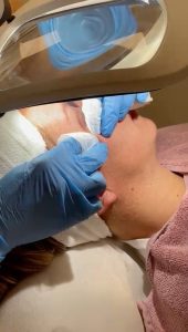 Kan Skin Clinic - Dieptereiniging