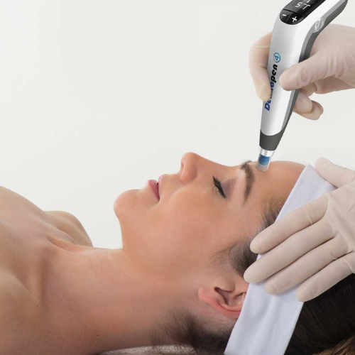 Microneedling met de Dermapen Kan Skin Clinic Bussum