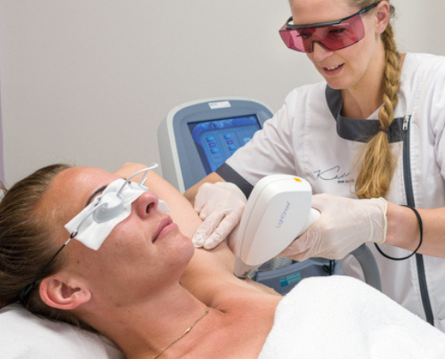 Laserontharing lichaam