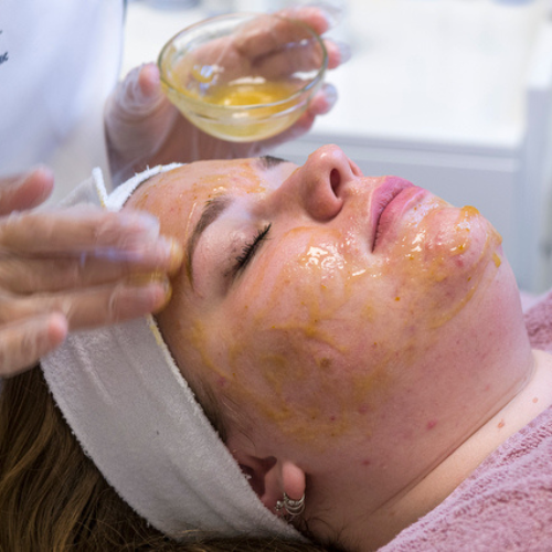 Huidanalyse 1e behandeling