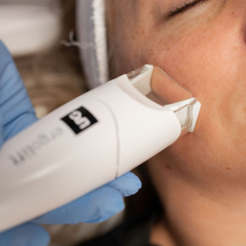 Radiance Renewal Facial