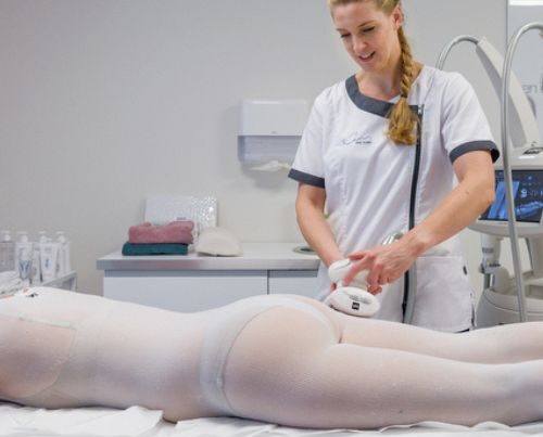 Lymfoedeem - Lipoedeem - Kan Skin Clinic Bussum